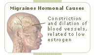 migraine headaches hormonal causes