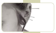 acupuncture relief from migraine headaches