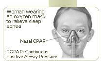 woman wearing an oxigen mask to relieve sleep apnea